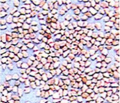 Đất chịu lửa: Nhẹ hơn cát nên có thể thay thế cát là 1 vật liệu lọc duy nhất